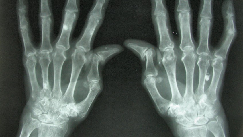 7 Pistol-Shooting Tips For People With Arthritis